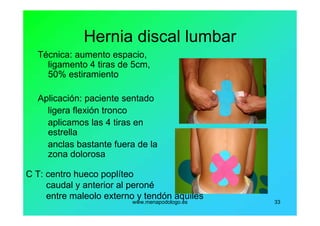 www.menapodologo.es 33
Hernia discal lumbar
Técnica: aumento espacio,
ligamento 4 tiras de 5cm,
50% estiramiento
Aplicación: paciente sentado
ligera flexión tronco
aplicamos las 4 tiras en
estrella
anclas bastante fuera de la
zona dolorosa
C T: centro hueco poplíteo
caudal y anterior al peroné
entre maleolo externo y tendón aquiles
 