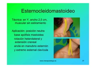 www.menapodologo.es 37
Esternocleidomastoideo
Técnica: en Y, ancho 2,5 cm,
muscular sin estiramiento
Aplicación: posición neutra
base apófisis mastoidea
rotación heterolateral y
extensión craneal
ancla en manubrio esternón
y extremo esternal clavícula
 