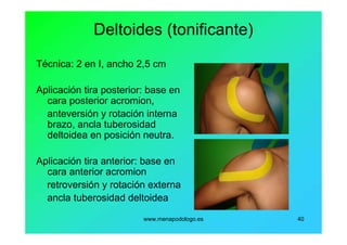 www.menapodologo.es 40
Deltoides (tonificante)
Técnica: 2 en I, ancho 2,5 cm
Aplicación tira posterior: base en
cara posterior acromion,
anteversión y rotación interna
brazo, ancla tuberosidad
deltoidea en posición neutra.
Aplicación tira anterior: base en
cara anterior acromion
retroversión y rotación externa
ancla tuberosidad deltoidea
 