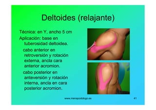 www.menapodologo.es 41
Deltoides (relajante)
Técnica: en Y, ancho 5 cm
Aplicación: base en
tuberosidad deltoidea.
cabo anterior en
retroversión y rotación
externa, ancla cara
anterior acromion.
cabo posterior en
anteversión y rotación
interna, ancla en cara
posterior acromion.
 