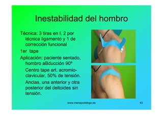 www.menapodologo.es 43
Inestabilidad del hombro
Técnica: 3 tiras en I, 2 por
técnica ligamento y 1 de
corrección funcional
1er tape
Aplicación: paciente sentado,
hombro aBducción 90º
Centro tape art. acromio-
clavicular, 50% de tensión.
Anclas, una anterior y otra
posterior del deltoides sin
tensión.
 