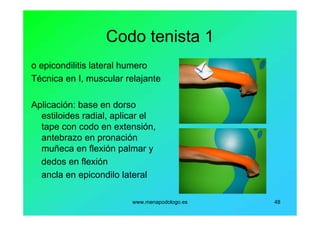 www.menapodologo.es 48
Codo tenista 1
o epicondilitis lateral humero
Técnica en I, muscular relajante
Aplicación: base en dorso
estiloides radial, aplicar el
tape con codo en extensión,
antebrazo en pronación
muñeca en flexión palmar y
dedos en flexión
ancla en epicondilo lateral
 