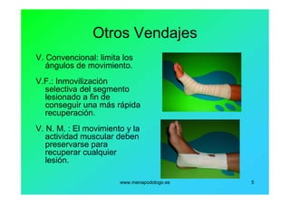 www.menapodologo.es 5
Otros Vendajes
V. Convencional: limita los
ángulos de movimiento.
V.F.: Inmovilización
selectiva del segmento
lesionado a fin de
conseguir una más rápida
recuperación.
V. N. M. : El movimiento y la
actividad muscular deben
preservarse para
recuperar cualquier
lesión.
 