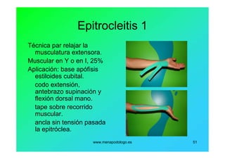 www.menapodologo.es 51
Epitrocleitis 1
Técnica par relajar la
musculatura extensora.
Muscular en Y o en I, 25%
Aplicación: base apófisis
estiloides cubital.
codo extensión,
antebrazo supinación y
flexión dorsal mano.
tape sobre recorrido
muscular.
ancla sin tensión pasada
la epitróclea.
 