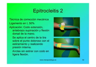 www.menapodologo.es 52
Epitrocleitis 2
Técnica de corrección mecánica
Ligamento en I, 50%
Aplicación: Codo extensión,
antebrazo supinación y flexión
dorsal de la mano.
Se aplica el centro de la tira
sobre el punto doloroso con el
estiramiento y realizando
presión interna.
Anclas sin estirar con codo en
ligera flexión.
 