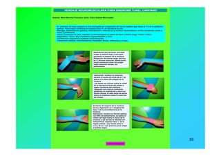 www.menapodologo.es 55
Autores: Mena Sánchez Francisco Javier, Calvo Galiana Maria Isabel
Realizamos dos técnicas, una para
relajar el palmar largo y otra para
aumentar el espacio de la muñeca.
Relajación del palmar largo: técnica
en Y, técnica muscular, desde punto
medio eminencia tenar del pulgar
hasta inserción bíceps, sin
estiramiento.
Aplicación: muñeca en posición
neutral, el punto de cruce de la Y se
aplica a la altura del pliegue de la
muñeca.
Las bases se colocan sobre la mitad
de la eminencia tenar del pulgar y
región hipotenar del meñique.
Después con codo en extensión,
antebrazo en supinación y mano en
flexión dorsal, el cabo largo se aplica
sobre el antebrazo hasta la inserción
del bíceps.
Aumento de espacio de la muñeca:
técnica ligamento en I, longitud del
tape ¾ de la circunferencia de la
muñeca.
Aplicación: muñeca en flexión palmar,
con 50% de estiramiento, se aplica el
centro del tape sobre el dorso de la
muñeca, y las anclas se abrazan sin
estiramiento, dejando libre ¼ de la
región palmar ( por donde pasa el
cruce de la Y que pusimos para relajar
el palmar largo)
VENDAJE NEUROMUSCULARA PARA SINDROME TUNEL CARPIANO
El síndrome del túnel carpiano es una neuropatía por compresión del nervio mediano que afecta al 3 % de la población
general. Tiene mayor incidencia en mujeres entre 4ª y 6ª década de la vida.
Etiología: predisposición genética, traumatismos o lesiones en la muñeca, hipotiroidismo, artritis reumatoide, quiste o
tumor y profesional.
Clínica: sensación de calor, calambre o entumecimiento en palma de mano y dedos pulgar, medio e índice.
Diagnóstico: clínico. Muy orientativos signos Phanllen y Tinel.
Confirmación diagnóstica mediante electromiografía
Tratamiento habitual: antiinflamatorios, fisioterpia, férulas, infiltración y cirugía.
menapodologo.es
 