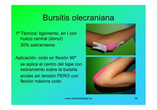 www.menapodologo.es 56
Bursitis olecraniana
1ª Técnica: ligamento, en I con
hueco central (donut)
30% estiramiento
Aplicación: codo en flexión 90º
se aplica el centro del tape con
estiramiento sobre la bursitis
anclas sin tensión PERO con
flexión máxima codo
 