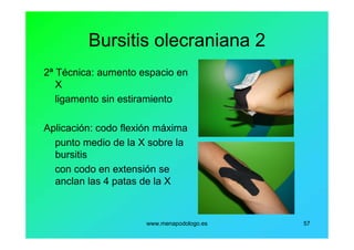 www.menapodologo.es 57
Bursitis olecraniana 2
2ª Técnica: aumento espacio en
X
ligamento sin estiramiento
Aplicación: codo flexión máxima
punto medio de la X sobre la
bursitis
con codo en extensión se
anclan las 4 patas de la X
 