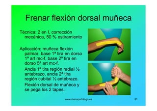 www.menapodologo.es 61
Frenar flexión dorsal muñeca
Técnica: 2 en I, corrección
mecánica, 50 % estiramiento
Aplicación: muñeca flexión
palmar, base 1ª tira en dorso
1ª art mc-f, base 2ª tira en
dorso 5ª art mc-f.
Ancla 1ª tira región radial ½
antebrazo, ancla 2ª tira
región cubital ½ antebrazo.
Flexión dorsal de muñeca y
se pega los 2 tapes.
 