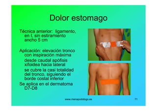 www.menapodologo.es 71
Dolor estomago
Técnica anterior: ligamento,
en I, sin estiramiento
ancho 5 cm
Aplicación: elevación tronco
con inspiración máxima
desde caudal apófisis
xifoidea hacia lateral
se cubre la casi totalidad
del tronco, siguiendo el
borde costal inferior
Se aplica en el dermatoma
D7-D8
 