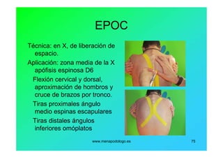 www.menapodologo.es 75
EPOC
Técnica: en X, de liberación de
espacio.
Aplicación: zona media de la X
apófisis espinosa D6
Flexión cervical y dorsal,
aproximación de hombros y
cruce de brazos por tronco.
Tiras proximales ángulo
medio espinas escapulares
Tiras distales ángulos
inferiores omóplatos
 