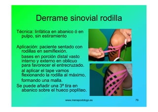 www.menapodologo.es 79
Derrame sinovial rodilla
Técnica: linfática en abanico ó en
pulpo, sin estiramiento
Aplicación: paciente sentado con
rodillas en semiflexión.
bases en porción distal vasto
interno y externo en oblicuo
para favorecer el entrecruzado.
al aplicar el tape vamos
flexionando la rodilla al máximo,
formando una malla.
Se puede añadir una 3ª tira en
abanico sobre el hueco poplíteo.
 