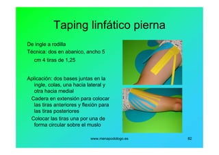 www.menapodologo.es 82
Taping linfático pierna
De ingle a rodilla
Técnica: dos en abanico, ancho 5
cm 4 tiras de 1,25
Aplicación: dos bases juntas en la
ingle, colas, una hacia lateral y
otra hacia medial
Cadera en extensión para colocar
las tiras anteriores y flexión para
las tiras posteriores
Colocar las tiras una por una de
forma circular sobre el muslo
 