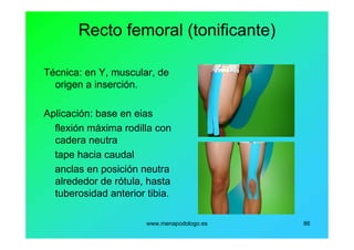 www.menapodologo.es 86
Recto femoral (tonificante)
Técnica: en Y, muscular, de
origen a inserción.
Aplicación: base en eias
flexión máxima rodilla con
cadera neutra
tape hacia caudal
anclas en posición neutra
alrededor de rótula, hasta
tuberosidad anterior tibia.
 