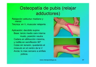 www.menapodologo.es 87
Osteopatía de pubis (relajar
adductores)
Relajación adductur mediano y
menor
Técnica: en V, muscular relajante
Aplicación: decúbito supino
Base: tercio medio cara interna
muslo, posición neutra
Cadera en aBducción máxima,
y rodilla en semiflexión 90º
Colas sin tensión, quedando el
músculo en el centro de la V
Ancla: lo mas cercano a sínfisis
púbica.
 