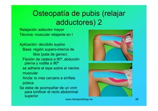 www.menapodologo.es 88
Osteopatía de pubis (relajar
adductores) 2
Relajación adductor mayor
Técnica: muscular relajante en I
Aplicación: decúbito supino
Base: región supero-interna de
tibia (pata de ganso)
Flexión de cadera a 90º, abdución
pierna y rodilla a 90º
se adhiere el tape sobre el vientre
muscular
Ancla: lo mas cercano a sínfisis
púbica
Se debe de acompañar de un vnm
para tonificar el recto abdominal
superior
 