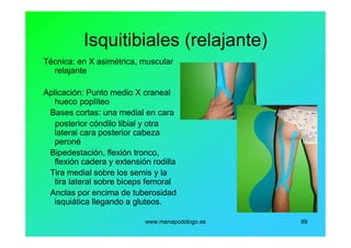 www.menapodologo.es 89
Isquitibiales (relajante)
Técnica: en X asimétrica, muscular
relajante
Aplicación: Punto medio X craneal
hueco poplíteo
Bases cortas: una medial en cara
posterior cóndilo tibial y otra
lateral cara posterior cabeza
peroné
Bipedestación, flexión tronco,
flexión cadera y extensión rodilla
Tira medial sobre los semis y la
tira lateral sobre biceps femoral
Anclas por encima de tuberosidad
isquiática llegando a gluteos.
 