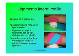 www.menapodologo.es 91
Ligamento lateral rodilla
Técnica: en I, ligamento
Aplicación: rodilla reposo en
ligera flexión.
tape sobre longitud
ligamento con anclas
distales a la articulación.
Para reforzar se aplica tape
en diagonal sobre la
primera tira con técnica
ligamento
 