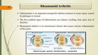 Rheumatoid Arthritis
 Inflammation is an important nonspecific defence reaction to tissue injury caused
by pathogen or wound.
 The five cardinal signs of inflammation are redness, swelling, heat, pain, loss of
function.
 Rheumatoid arthritis is an autoimmune disease that causes chronic inflammation
of the joints.
10
 