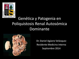 Genética y Patogenia en 
Poliquistosis Renal Autosómica 
Dominante 
Dr. Daniel Agüero Velásquez 
Residente Medicina Interna 
Septiembre 2014 
 