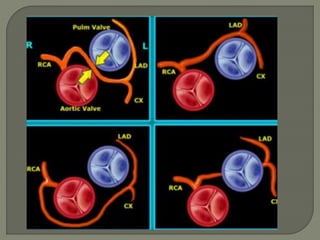 CT Coronary angiography | PPTX