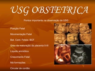 USG OBSTETRICA Pontos importante na observação da USG Posição Fetal Movimentação Fetal Bat. Card. Fetais- BCF Grau da maturação da placenta 0-III Liquido amniótico  Crescimento Fetal Má formações  Circular de cordão 