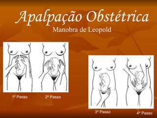 Apalpação Obstétrica Manobra de Leopold 1º Passo 2º Passo 3º Passo 4º Passo 