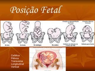 Posição Fetal Cefálica Pélvica  Transversa Longitudinal Vertical 
