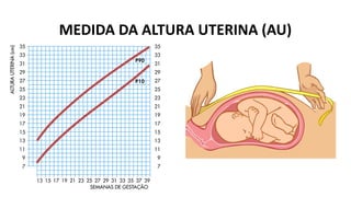 MEDIDA DA ALTURA UTERINA (AU)
 