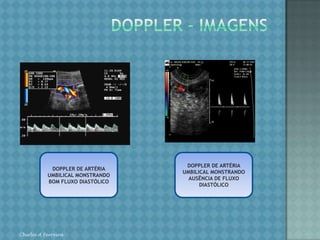 PERFIL BIOFÍSICO FETAL