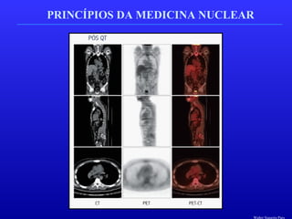 PRINCÍPIOS DA MEDICINA NUCLEAR
Walter Siqueira Paes
 