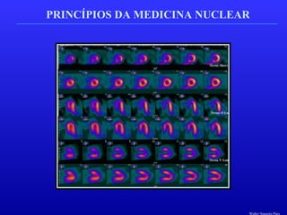 PRINCÍPIOS DA MEDICINA NUCLEAR
Walter Siqueira Paes
 