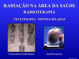RADIOTERAPIA
RADIAÇÃO NA ÁREA DA SAÚDE
TELETERAPIA - FONTES SELADAS
Colimadores Individuais Imobilizadores
Walter Siqueira Paes
 
