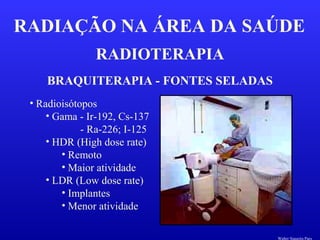 RADIOTERAPIA
RADIAÇÃO NA ÁREA DA SAÚDE
BRAQUITERAPIA - FONTES SELADAS
• Radioisótopos
• Gama - Ir-192, Cs-137
- Ra-226; I-125
• HDR (High dose rate)
• Remoto
• Maior atividade
• LDR (Low dose rate)
• Implantes
• Menor atividade
Walter Siqueira Paes
 