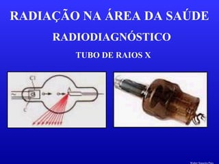 RADIODIAGNÓSTICO
RADIAÇÃO NA ÁREA DA SAÚDE
TUBO DE RAIOS X
Walter Siqueira Paes
 