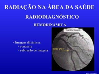 RADIODIAGNÓSTICO
RADIAÇÃO NA ÁREA DA SAÚDE
HEMODINÂMICA
• Imagens dinâmicas
• contraste
• subtração de imagens
Walter Siqueira Paes
 