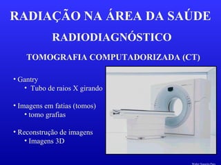 RADIODIAGNÓSTICO
RADIAÇÃO NA ÁREA DA SAÚDE
TOMOGRAFIA COMPUTADORIZADA (CT)
• Gantry
• Tubo de raios X girando
• Imagens em fatias (tomos)
• tomo grafias
• Reconstrução de imagens
• Imagens 3D
Walter Siqueira Paes
 