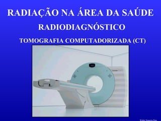 RADIODIAGNÓSTICO
RADIAÇÃO NA ÁREA DA SAÚDE
TOMOGRAFIA COMPUTADORIZADA (CT)
Walter Siqueira Paes
 
