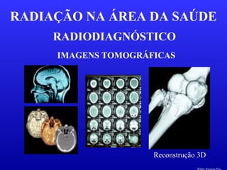 RADIODIAGNÓSTICO
RADIAÇÃO NA ÁREA DA SAÚDE
IMAGENS TOMOGRÁFICAS
Reconstrução 3D
Walter Siqueira Paes
 
