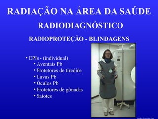 RADIODIAGNÓSTICO
RADIAÇÃO NA ÁREA DA SAÚDE
RADIOPROTEÇÃO - BLINDAGENS
• EPIs - (individual)
• Aventais Pb
• Protetores de tireóide
• Luvas Pb
• Óculos Pb
• Protetores de gônadas
• Saiotes
Walter Siqueira Paes
 