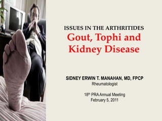 ISSUES IN THE ARTHRITIDES
Gout, Tophi and
Kidney Disease

SIDNEY ERWIN T. MANAHAN, MD, FPCP
           Rheumatologist

       18th PRA Annual Meeting
           February 5, 2011
 