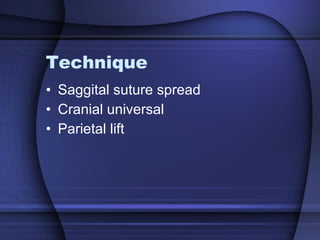 Technique Saggital suture spread Cranial universal  Parietal lift 