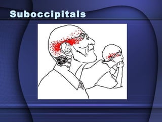 Suboccipitals   