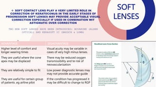  SOFT CONTACT LENS PLAY A VERY LIMITED ROLE IN
CORRECTION OF KERATOCONUS IN THE EARLY STAGES OF
PROGRESSION SOFT LENSES M...