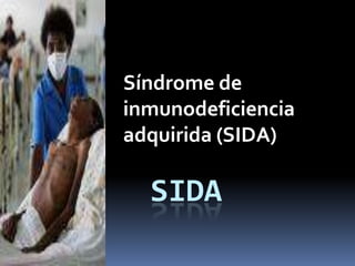 SIDA Síndrome de inmunodeficiencia adquirida (SIDA) 