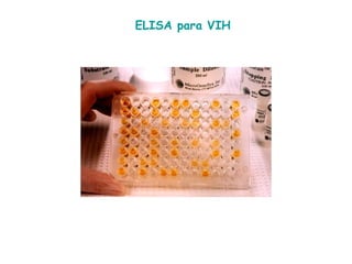 ELISA para VIH 