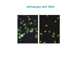 Anticuerpos anti-DNA 