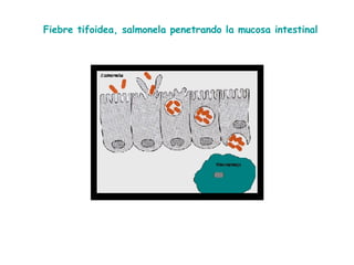 Fiebre tifoidea, salmonela penetrando la mucosa intestinal 