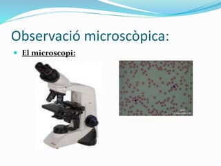 Observació microscòpica:
 El microscopi:
 