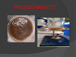 PROCEDIMIENTO:
 